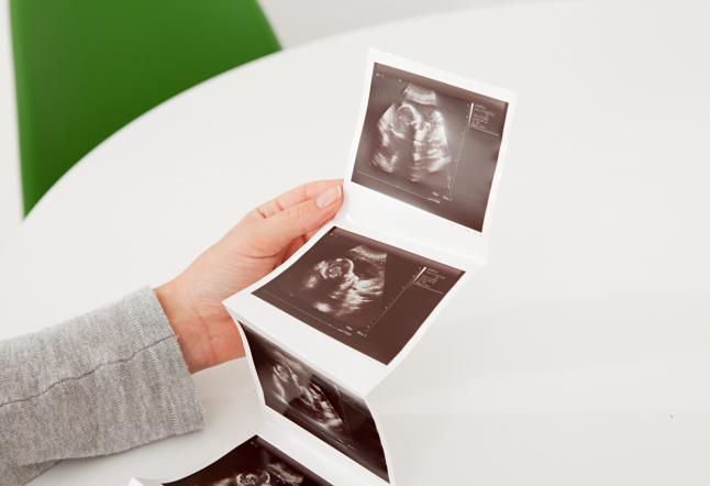 Woman holding baby scan