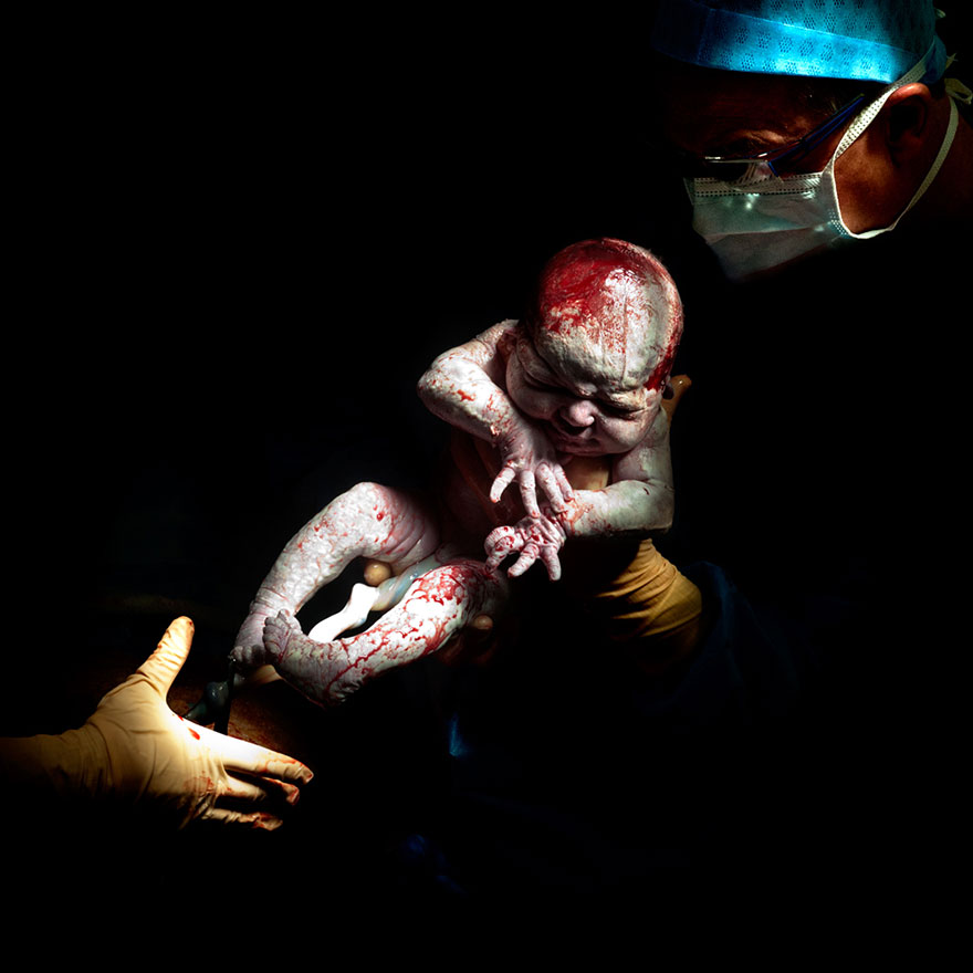 newborn-infant-photos-c-section-cesar-christian-berthelot-2