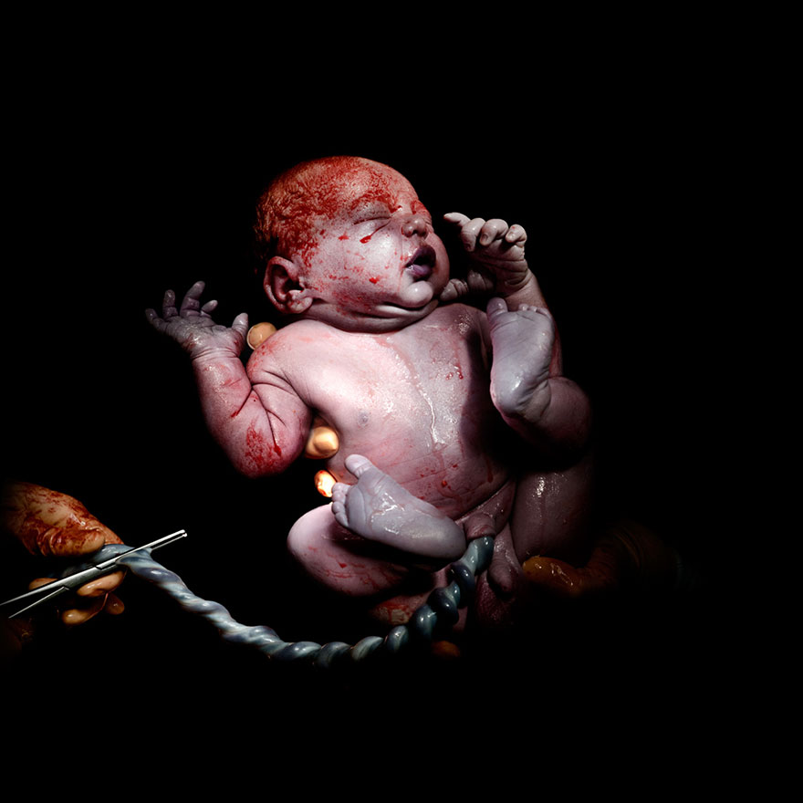 newborn-infant-photos-c-section-cesar-christian-berthelot-6