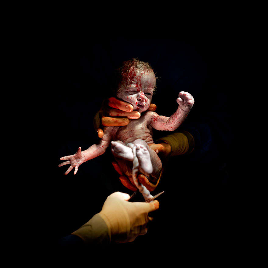 newborn-infant-photos-c-section-cesar-christian-berthelot-7
