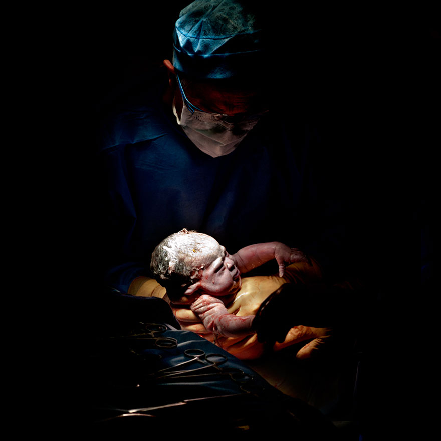 newborn-infant-photos-c-section-cesar-christian-berthelot-9