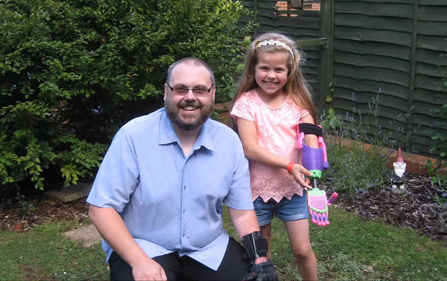3d-printed-prosthetic-arm-stephen-davies-enable-isabella-5